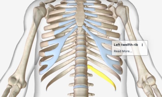 false floating rib - the twelfth rib syndrome