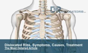 Dislocated ribs, Symptoms, Causes, Treatment- The Most Detailed Article